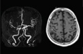  MRI vs MRA, װ ñϴ !