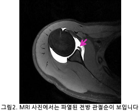 Ŭ Ż   ׸2. MRI  Ŀ   Դϴ.