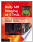 Body MR Imaging at 3 Tesla