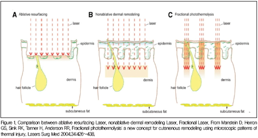 Į  figure1