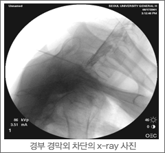  渷  x-ray 