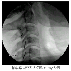     x-ray 