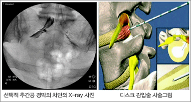 []  ߰ 渷  x-ray , [] ٽũ м ü׸