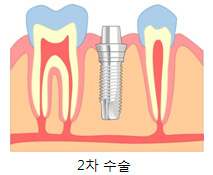 2  ׸