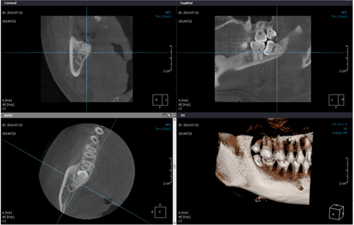 Cone beam CT ̿ 3 ̹